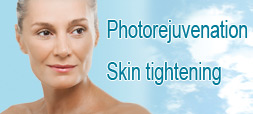 laser photorejuvenation