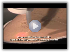 Laser Hair Removal of Underarm With LightPod Neo 1064nm Laser from Aerolase